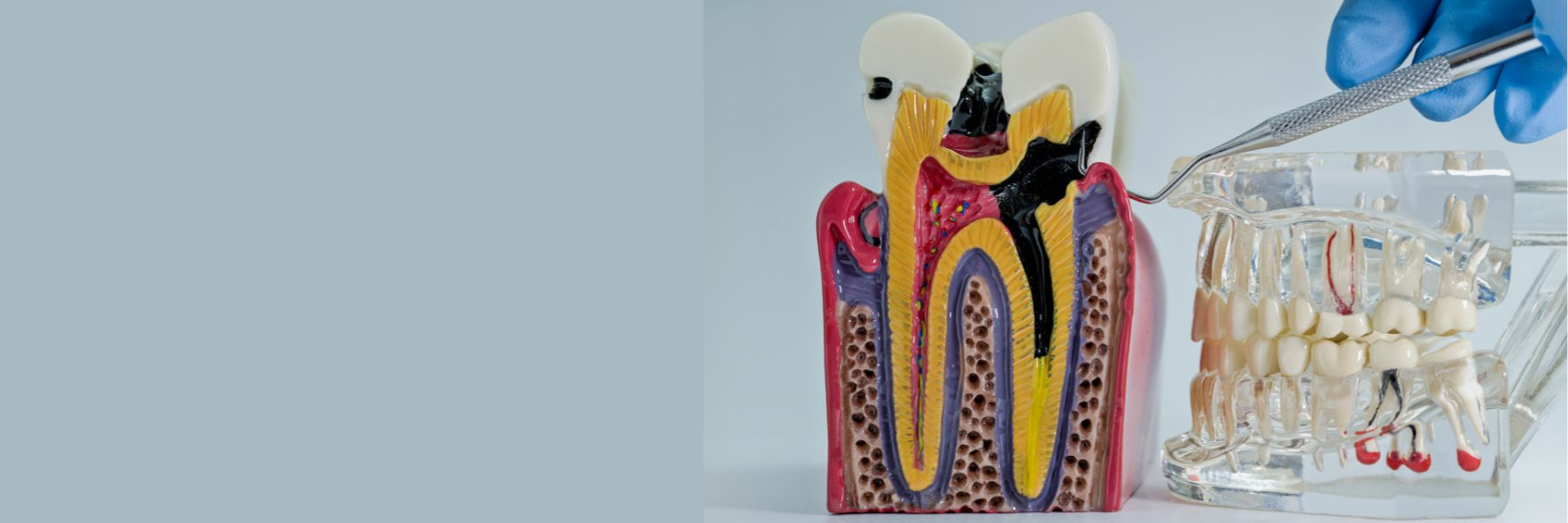 Emergency Dentistry | Dentist